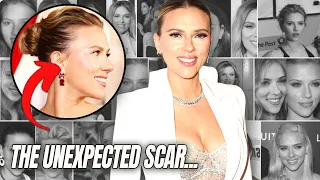 Scarlett Johannson’s NEWEST Plastic Surgery Reveal and a Mistake I Made ..