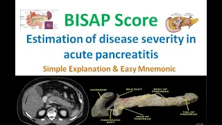 BISAP Score - Acute Pancreatitis | Simple Explanation | Easy Mnemonic