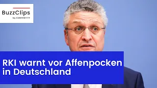 RKI warnt vor Affenpocken in Deutschland