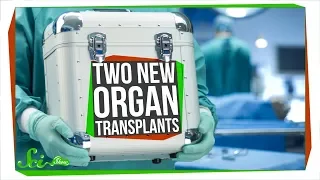 Two Unbelievable New Transplants That Actually Worked