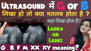 Ultrasound me kaha likha hai Ladka hoga ya Ladki || G, M , F , B , XX, XY terms in ultrasound