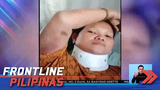 Nanay, limang iba pa, sugatan sa nagkaaberyang ride sa perya