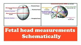 Fetal head measurements