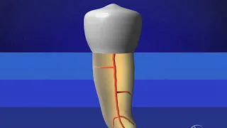 Glide Path Management -  Preparation Sequence: Advanced Endodontics