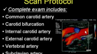 Cerebrovascular Ultrasound   How to Do It Well