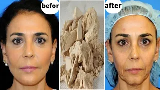 Japanese secret to looking 10 years younger than your age/anti aging remedy