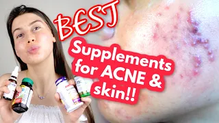 THE SUPPLEMENTS I TAKE FOR MY ACNE AND TO ACHIEVE GLOWY, HEALTHY SKIN!! || best supplements for skin
