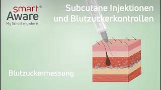 Subcutane Injektionen: Blutzuckermessung | Fachfortbildungen in der Pflege | smartAware