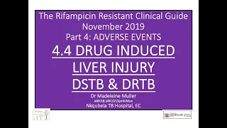 DILI in DSTB and DRTB Dr Muller RRTB tutorial