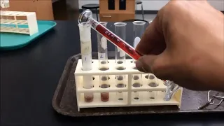 Liver and Catalase makeup lab video