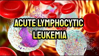 Acute Lymphocytic Leukemia - CRASH! Medical Review Series