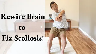 How to Fix Your Scoliosis Permanently: A Brain and Movement Retraining Guide 1