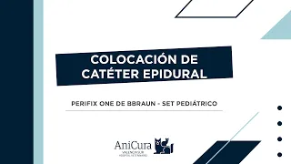 👉 ¿Cómo colocar un Catéter Epidural?