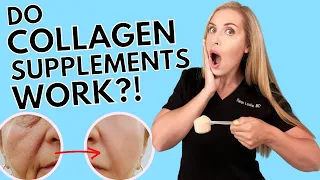 Do Collagen Supplements Work?! |Anti-aging Skincare PART 1