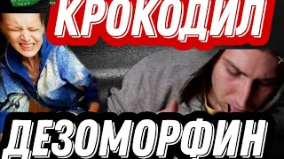 🔴ДЕЗОМОРФИН //КРОКОДИЛ //ГНИЮЩИЕ ЗАЖИВО //ПОСЛЕДСТВИЯ УПОТРЕБЛЕНИЕ  ДЕЗОМОРФИНА