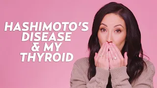 How My Hashimoto's Disease Affects My Appearance (Hypothyroid Symptoms) | Skincare with @Susan Yara