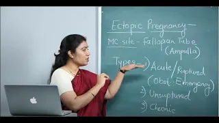 OBSTETRICS & GYNECOLOGY: ECTOPIC PREGNANCY