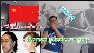 Chinese boy's  reaction to Korean Plastic Surgery Before and After Photos