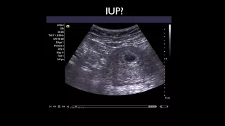 Essential First Trimester Pelvic Ultrasound  for physician - HD [Basic Radiology]