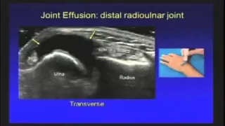 MSK   Wrist and Hand Ultrasound   JacobsonTRIMMED