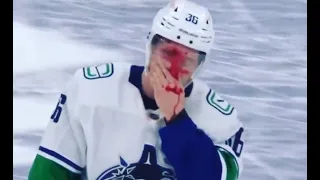 Nils Höglander Takes Puck To Face | Canucks vs Maple Leafs 2-8-21