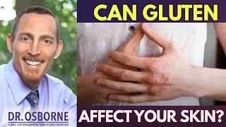 Does Gluten Cause Skin Problems?