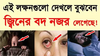 আপনার, জ্বিনের বদ নজর লেগেছে কি না যাচাই করে নিন!