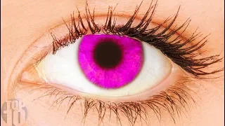 11 Rarest Eye Colors In Humans