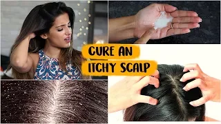 6 WINTER Haircare Hacks To Get Rid Of An Itchy Scalp Naturally At Home/ Tips & Tricks