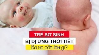 Trẻ sơ sinh bị DỊ ỨNG THỜI TIẾT. Ba mẹ cần làm gì để giúp con? | BLUECARE