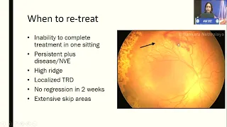 AIOC2022 IC137 topic Dr  BANKER ALAY S  Role of anti VEGF and laser in ROP