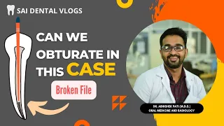 CAN WE OBTURATE WITH A BROKEN FILE INSIDE ROOT CANAL? TOP 3 CAUSES