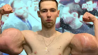 Russian Slap Champion DESTROYS Fake Synthol Muscle Man | The Russian Hulk Saga