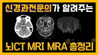 신경과전문의가 알려주는 뇌CT, MRI, MRA 총정리 #뇌CT #뇌MRI #뇌MRA #어떨때어떤뇌검사? #뇌검사 #뇌검사총정리 #신경과전문의 #신경과 #부산신경과 #손제용