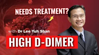 HIGH D-DIMER ‼️ NEED TO BE TREATED? BY DR LEE YUH SHAN