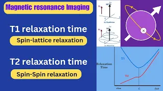 T1 Relaxation & T2 Relaxation  ll magnetic resonance imaging ll Radiography simplified