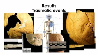 BIOARCHAEOLOGICAL AND MULTI-ISOTOPIC INVESTIGATIONS ON MEDIEVAL HUMAN SKELETONS