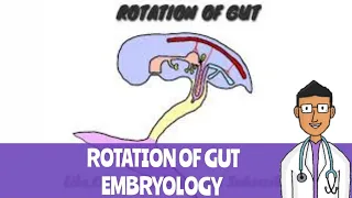 Rotation of Gut #embryology