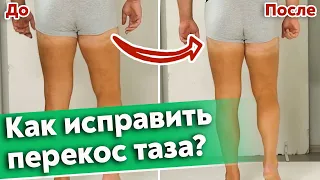 К чему приводит смещение таза? / Как исправить перекос таза?