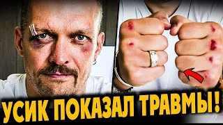 УСИК ПОКАЗАЛ ТРАВМЫ! Что Сказал Кличко Усику ПОСЛЕ Победы, ПОЗОР Судьи, Тайсон Согласен на Реванш