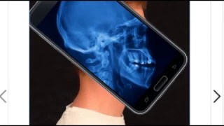 Мобильное приложение Рентген