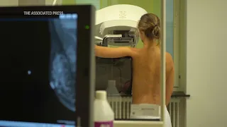 Mammograms should start at 40 to address rising breast cancer rates at younger ages, panel says