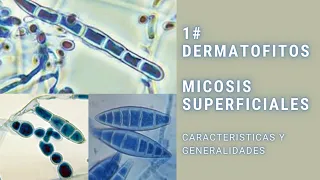 Micosis superficiales || #1 || Dermatofitos || Trichophyton || Epidermophyton || Microsporum