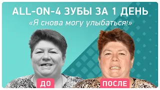 Имплантация all-on-4: как вернуть зубы за 1 день