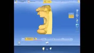 Maryland Bridge in Russian,CEREC InLab 4.2.5