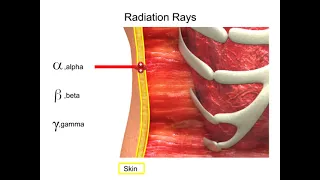 Radiation Rays  Alpha, Beta and Gamma