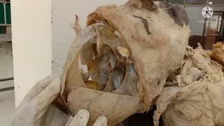 cranial cavity, brain removal