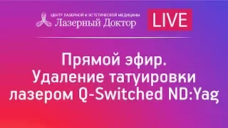 Прямой эфир. Удаление татуировки лазером Q-Switched ND:Yag