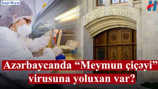 Azərbaycanda “Meymun çiçəyi” virusuna yoluxan var? - Səhiyyə Nazirliyindən açıqlama