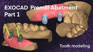 Exocad Premill Abatment I Tooth Modeling 21